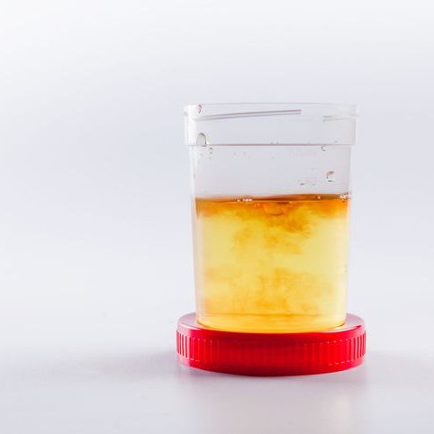 Blood In Urine